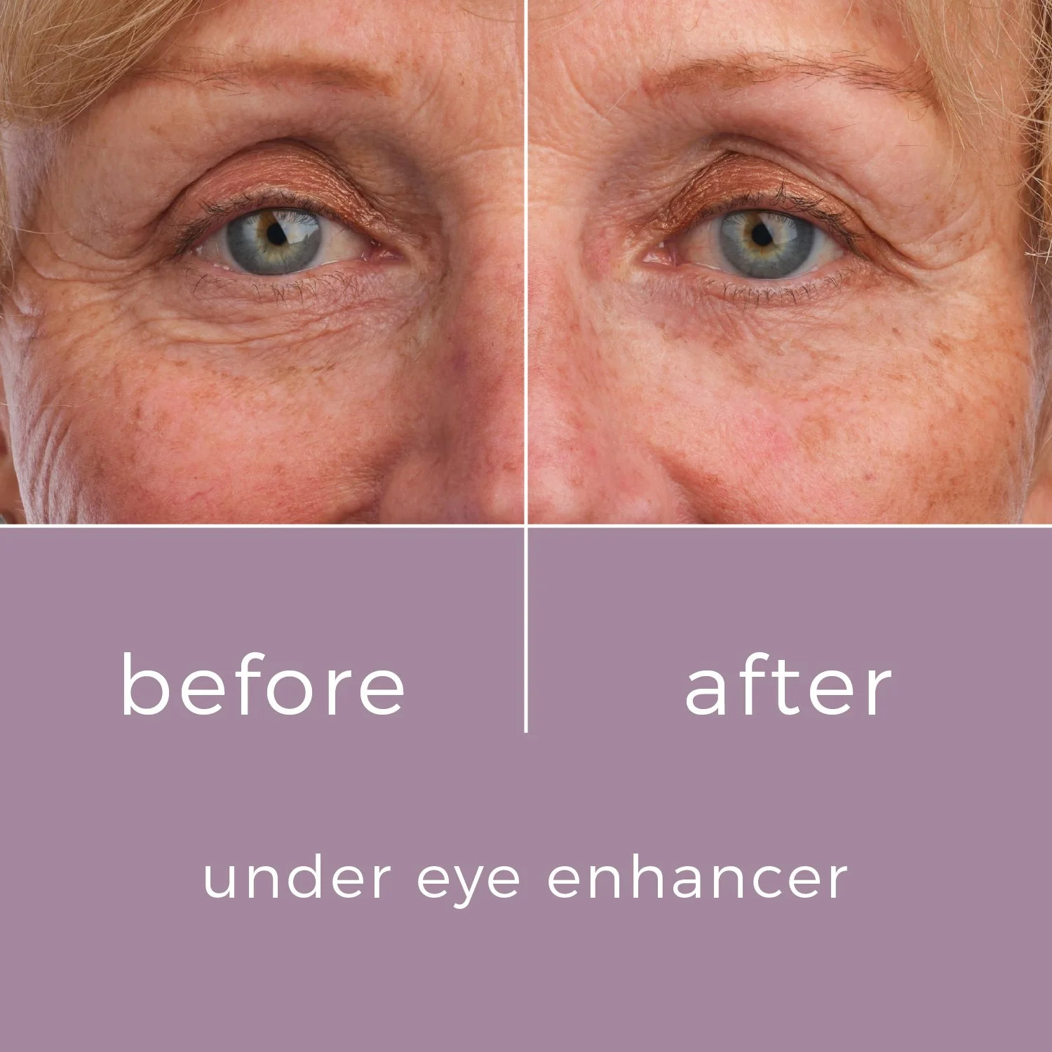 skin bunny under eye enhancer